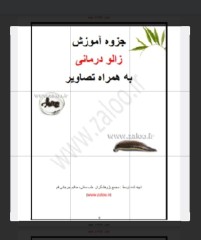 زالو درمانی